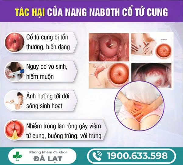 Hình ảnh minh họa